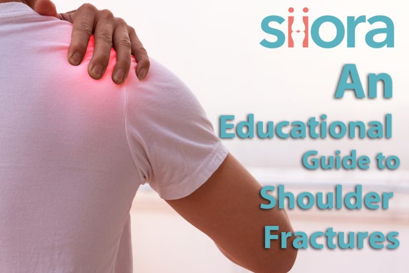 An Educational Guide to Shoulder Fractures