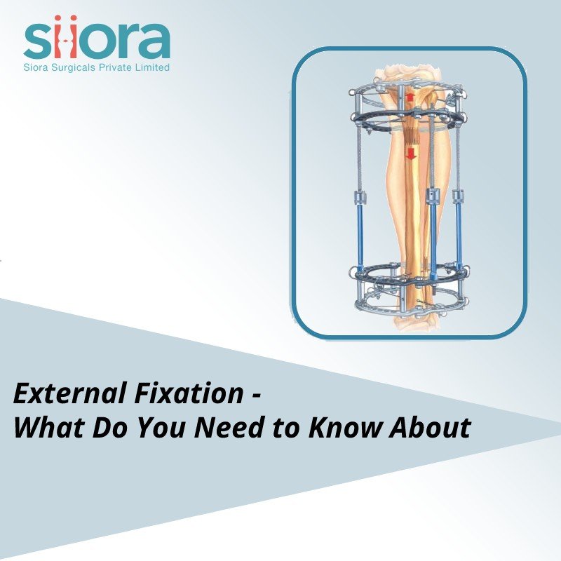Ilizarov External Fixation System, Ilizarov External Fixation System  Manufacturer, Ilizarov External Fixation System Suppliers, Orthopedic  Implants, India