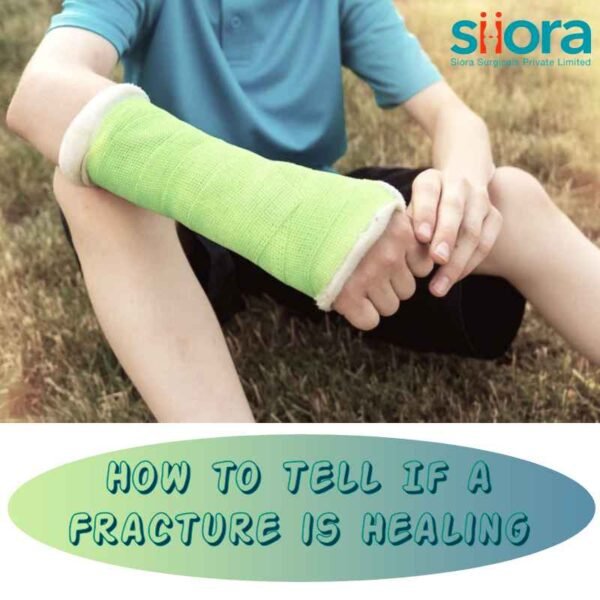 Fracture Healing Signs A Quick Guide Siora Surgicals Pvt Ltd