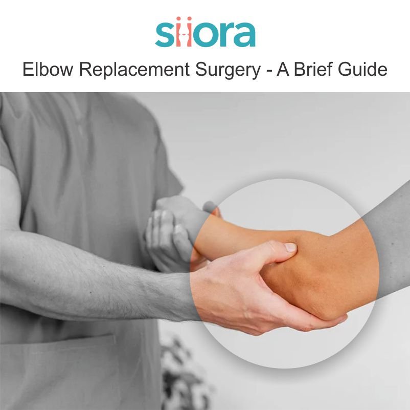 Elbow Replacement Surgery