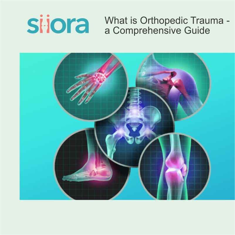 Read more about the article What is Orthopedic Trauma? A Comprehensive Guide