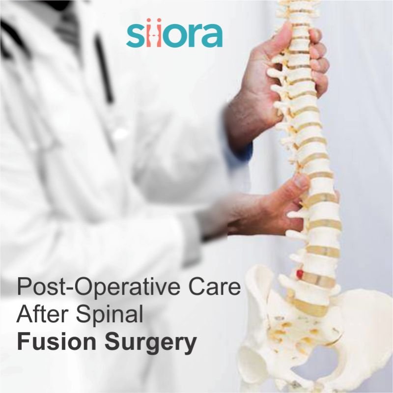 Read more about the article Postoperative Care After Spinal Fusion Surgery